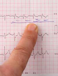 Career Cardiac Cardiovascular Disease