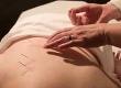 Work as an Acupuncturist