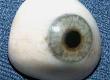 Working in Ocular Prosthetics