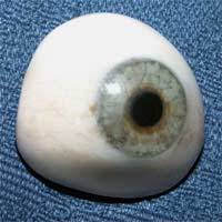 Career Ocular Prosthetics Eyes Patients